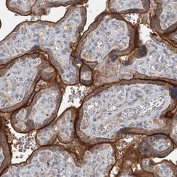 SLC39A8/ZIP8 Antibody, Novus Biologicals:Antibodies:Primary Antibodies